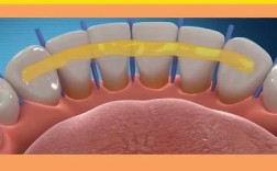 做固定牙齿的方法有哪些？如何正确选择？