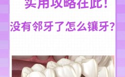 长沙镶牙的方法有哪些？各自特点是什么？