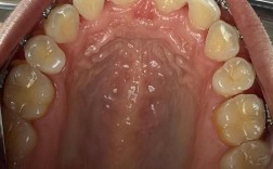 四川省医院矫正牙齿效果如何？价格贵不贵？医生靠谱吗？