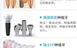 种牙选韩国还是德国？技术、价格、效果怎么比？