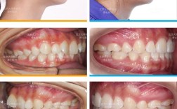 北京大学海外正畸