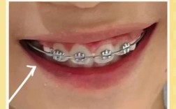 儿童几岁正畸比较好