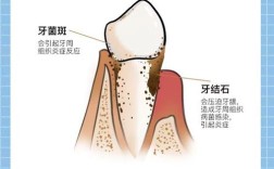 种牙前为何必须洗牙？洗牙的关键作用是什么？