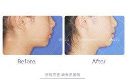 郑州矫正牙齿哪家好？求推荐靠谱的医院和医生！