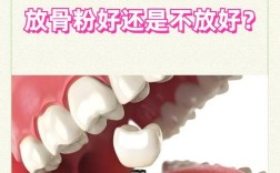 种牙放骨胶原的费用大概需要多少？