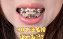 成人牙齿矫正过程图片能看出牙齿矫正的哪些关键变化？