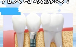 种牙二期手术拆线后需要注意哪些事项？拆线时间有统一标准吗？拆线过程会疼吗？