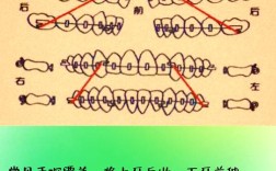 正畸J勾的使用方法