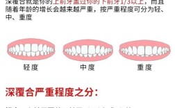 正畸压低上后牙的常用方法有哪些？