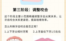 MBT牙齿矫正的标准流程是怎样的？包含哪些关键步骤？