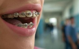 后牙损坏可以正畸吗