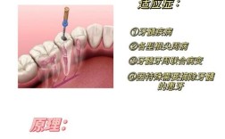 牙根的拔除方法