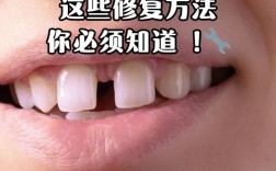 牙缝大有什么方法修补