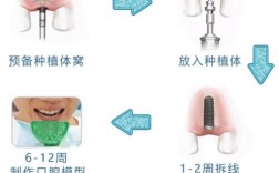 牙骨太短怎么种牙