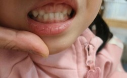 正畸完成后是否需要照片