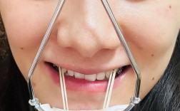 正畸三类牵引地包天