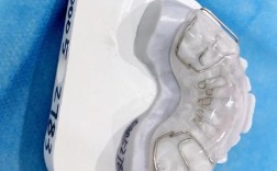 正畸弹簧吞下去了