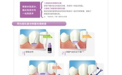 正畸粘结剂使用说明