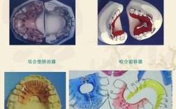 正畸丝弯环在牙齿矫正中有哪些关键作用？