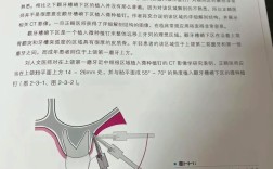 口腔正畸支抗钉型号多样，不同型号在临床适用情况、选择关键因素及治疗效果上存在哪些差异？