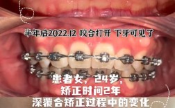 手术矫正牙齿好吗