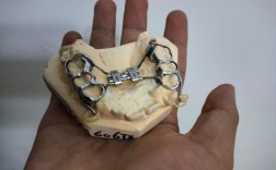 正畸螺旋扩弓器图片