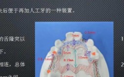 义齿支架打磨的制作方法