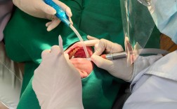 根管治疗 牙齿正畸