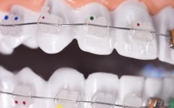 牙齿矫正odi