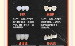 种牙后牙冠品牌怎么选？有哪些靠谱品牌推荐？