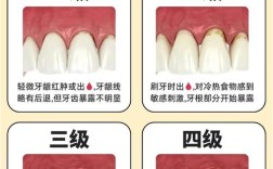 牙齿窝沟五种分型的划分标准是什么？不同分型对龋病预防及窝沟封闭术的选择有何指导意义？