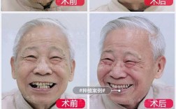 广州公益种牙假的消息是否属实？是真的吗？