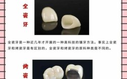 镶牙、种牙、烤瓷牙三者有何本质区别？适用人群与优缺点分别是什么？