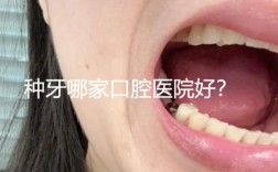 种牙能刷医保卡吗？
