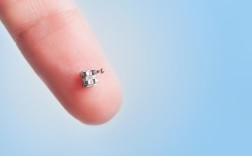 牙齿正畸时托槽突然掉了是什么原因导致的？需要马上处理吗？会不会影响最终的矫正效果？