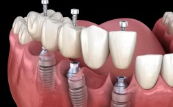 2025种一颗牙，这些新趋势你准备好了吗？