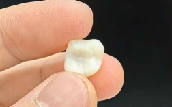 种牙后临时牙能用多久？日常护理要注意啥？