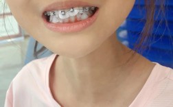 十岁女孩处于生长发育期，种植牙是否可行？需满足哪些条件？会不会影响颌骨正常发育？