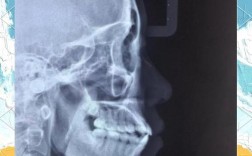 北大口腔正畸为何受欢迎？效果如何？