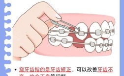 蛀牙数量较多的情况下，还能顺利开展正畸治疗吗？治疗前是否需要先处理蛀牙问题？