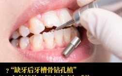 种牙植骨后能玩电脑吗