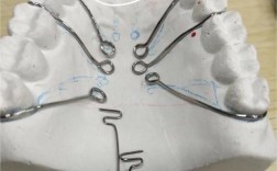 口腔正畸邻间钩的制作