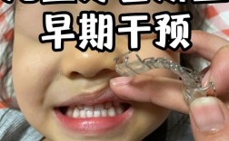 12岁孩子正畸时，拔牙是必须步骤吗？不拔牙会影响矫正效果或牙齿健康吗？