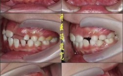 正畸过程中不适感因何而来？如何科学缓解才能更舒适？