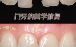 门牙修补后还能做正畸吗？