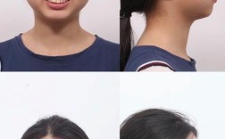 正畸摄影是什么？为何牙齿矫正前必须拍摄？