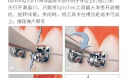 矫正方法中进口金属托槽矫正效果具体比普通托槽更好呢？