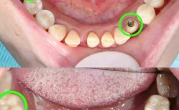 种牙真要种种子吗？牙齿到底从何而来？