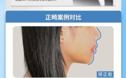 牙齿拥挤矫正方法有哪些？如何选择适合自己的矫正方式？