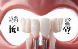 2025全口种植牙还自然吗？当前技术效果如何？